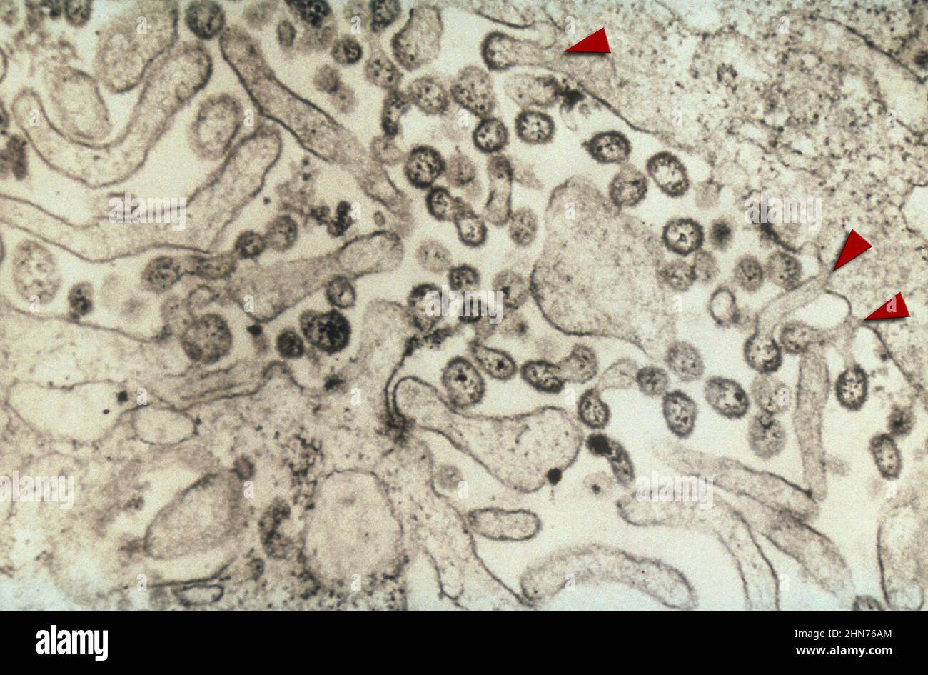 TEM-Bild mit zahlreichen Lassa-Virus-Virionen. Viele der Virionen können außerhalb der Wirtszelle gesehen werden, aber einige sind weggebrochen Stockfoto