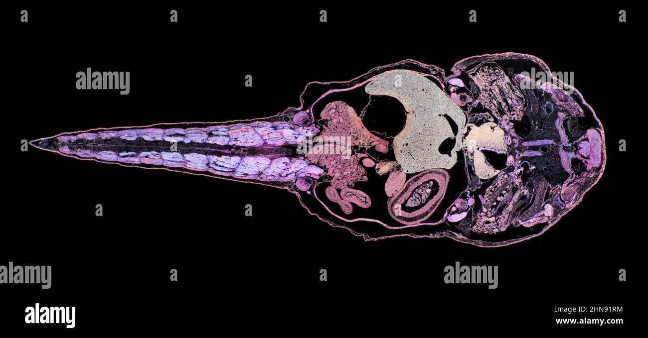 Frosch Kaulquappe, vertikaler Schnitt, während der Metamorphose zum erwachsenen Frosch, Photomikrograph. Stockfoto