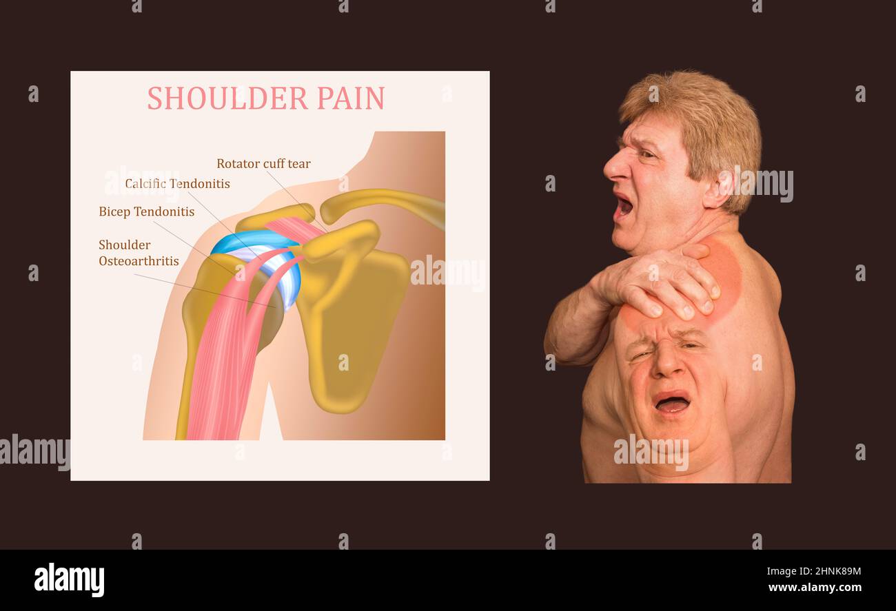 Schultergelenkstruktur beschriftet. Stockfoto