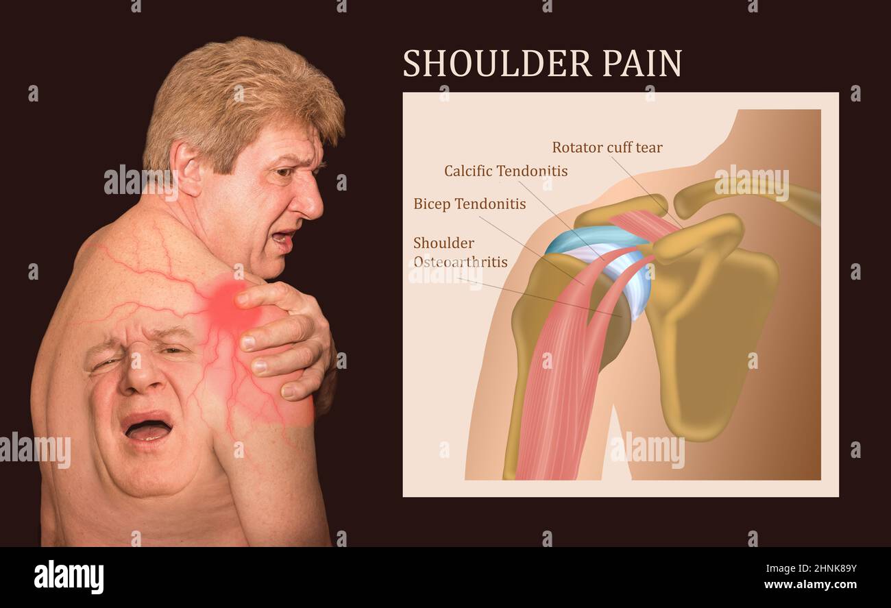 Schultergelenkstruktur beschriftet. Stockfoto