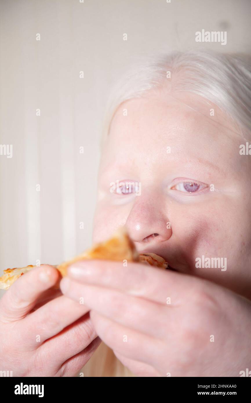 Albino-Frau, Die Pizza Gegessen Hat, Ist Rückständig Stockfoto