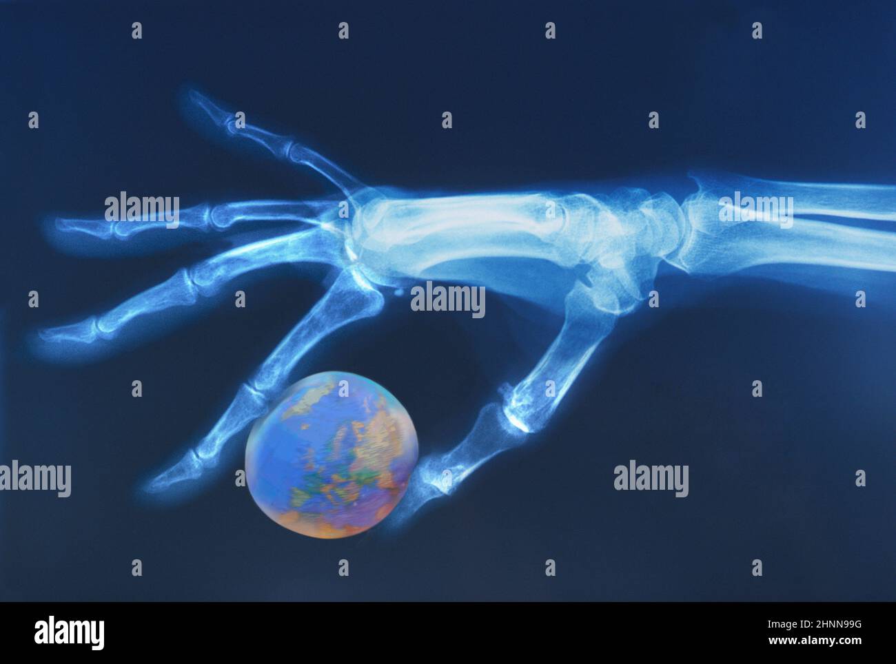 Röntgenbild der menschlichen Hand, die die Weltkugel hält. Europa und Naher Osten zeigen. Krieg, globale Erwärmung, Öl. Weltkrise. Der Planet Klimawandel Stockfoto
