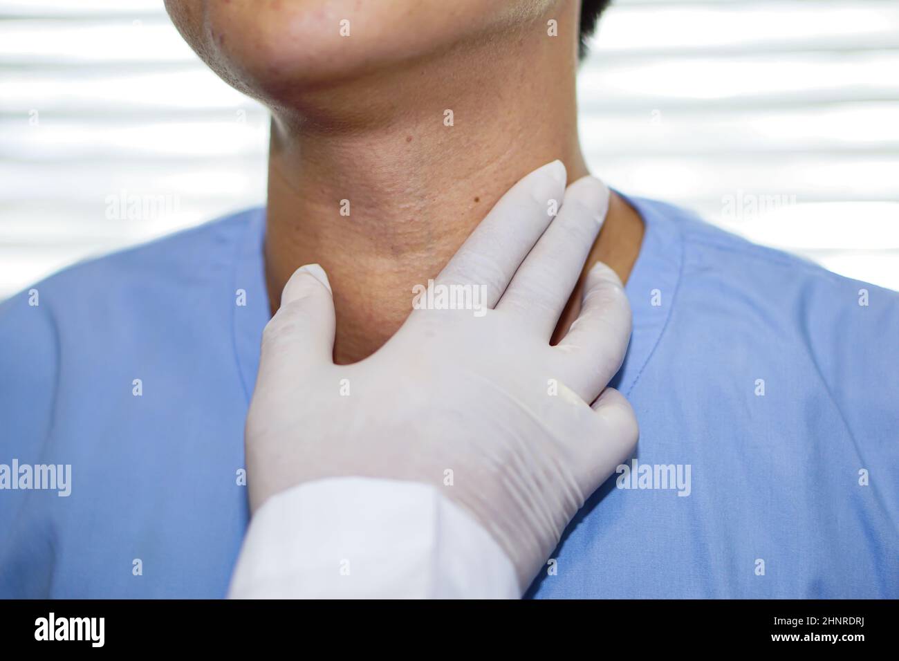 Asiatische Dame Frau Patienten haben abnorme Vergrößerung der Schilddrüse Hyperthyreose (überaktive Schilddrüse) an der Kehle, gesunde starke medizinische Konzept Stockfoto