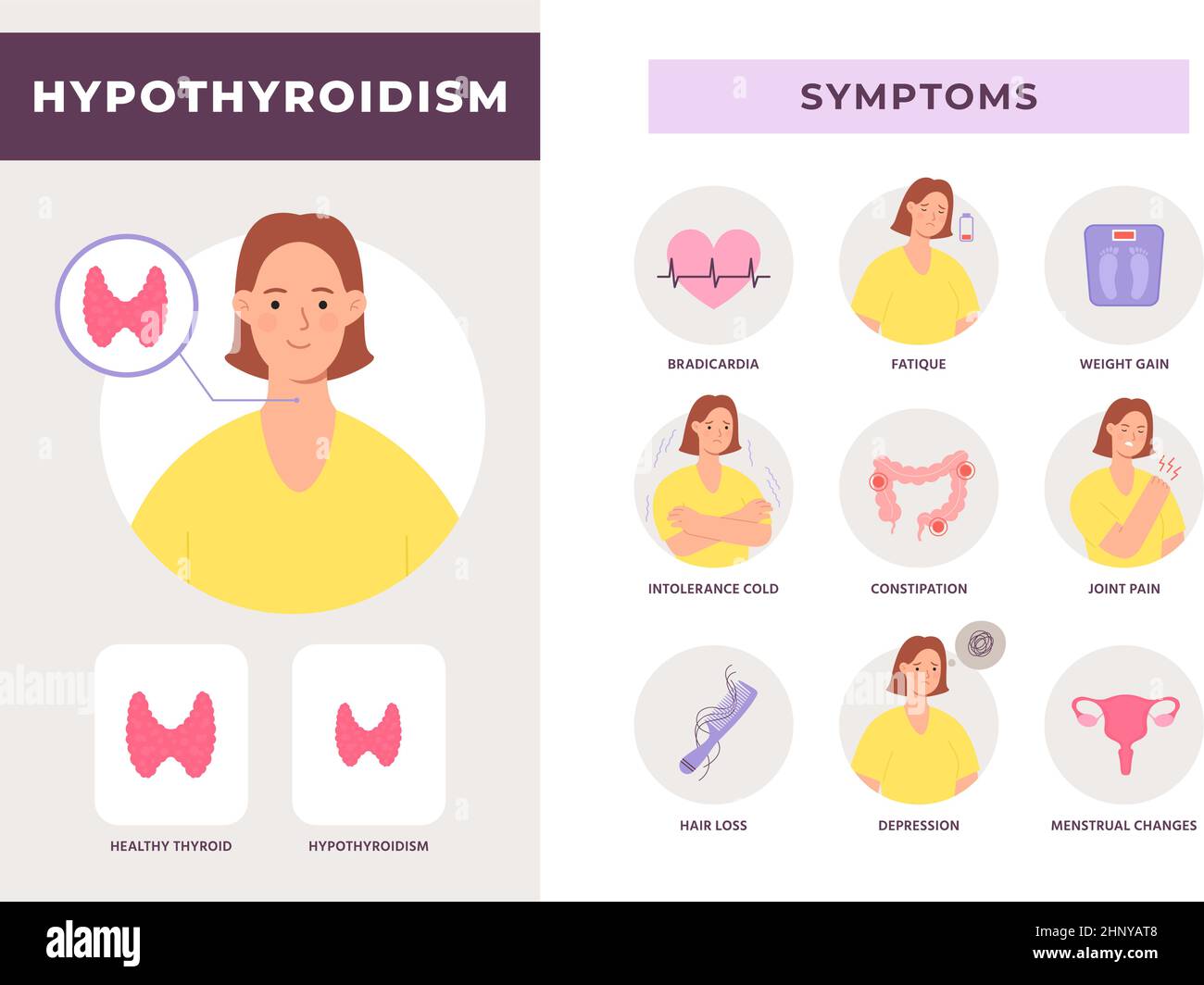 Infografik zu Symptomen einer Hypothyreose-Erkrankung mit Frauencharakter. Unteraktive Schilddrüse. Endokrines System Gesundheit Problem Vektor-Poster. Illustrati Stock Vektor