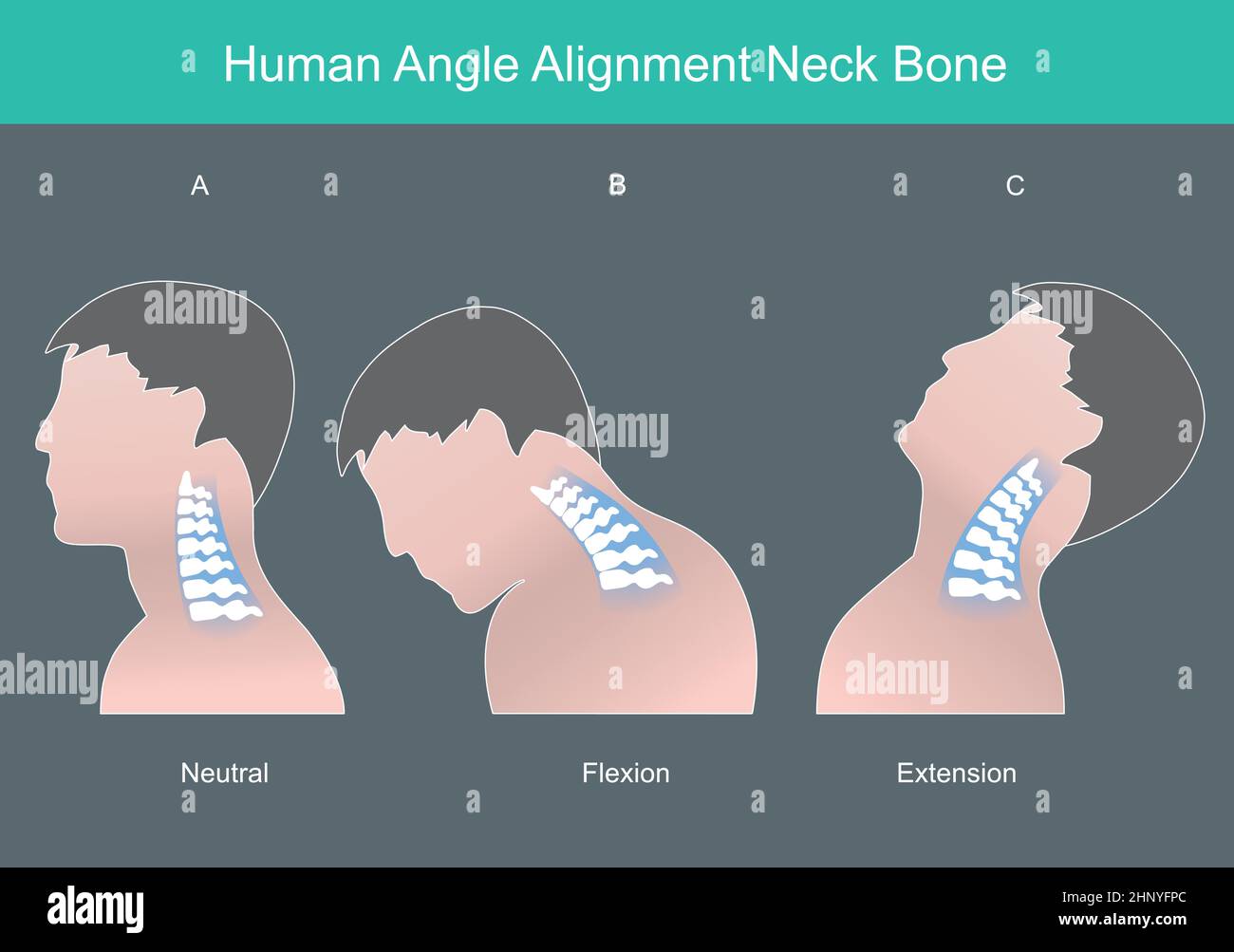 Menschlicher Winkelausrichtungs-Nackenknochen. Menschlicher Nackenknochen in korrekten Winkeln. Infografik zur Illustration. Stock Vektor