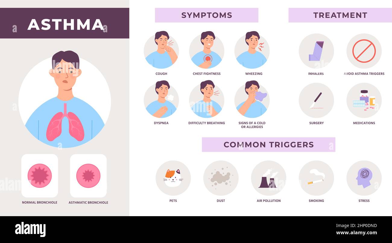 Infografik zur Asthmaerkrankung mit Symptomen, Behandlung und häufigen Auslösern. Mann mit Husten, Keuchen und Atemnot. Vektorinformationen zu Atemschwierigkeiten. Illustra Stock Vektor