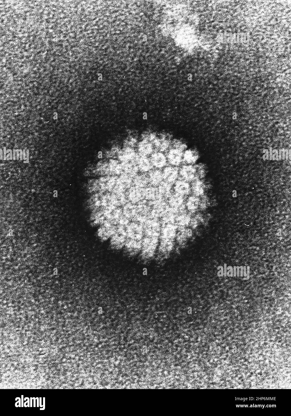 Elektronenmikrographie eines negativ gefärbten humanen Papillomvirus (HBV), das in humanen Warzen vorkommt. Warzen an Händen und Füßen sind nie bekannt, dass sie zu Krebs gelangen. Nach vielen Jahren können jedoch Halswirbelwarzen krebsartig werden. Ca. 1986 Stockfoto