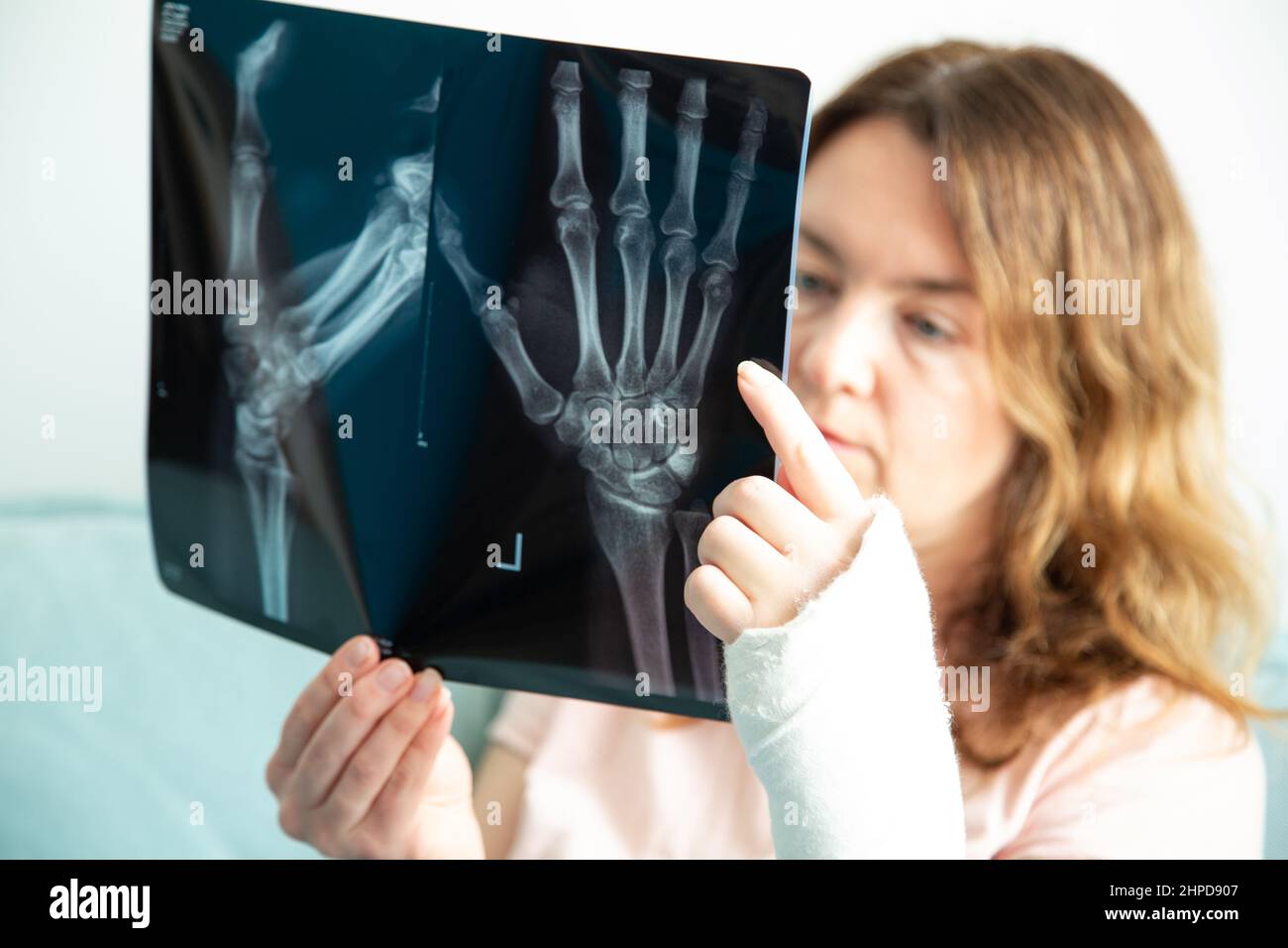 Frau mit gebrochenem Arm schaut auf ihre Röntgenaufnahme. Stockfoto