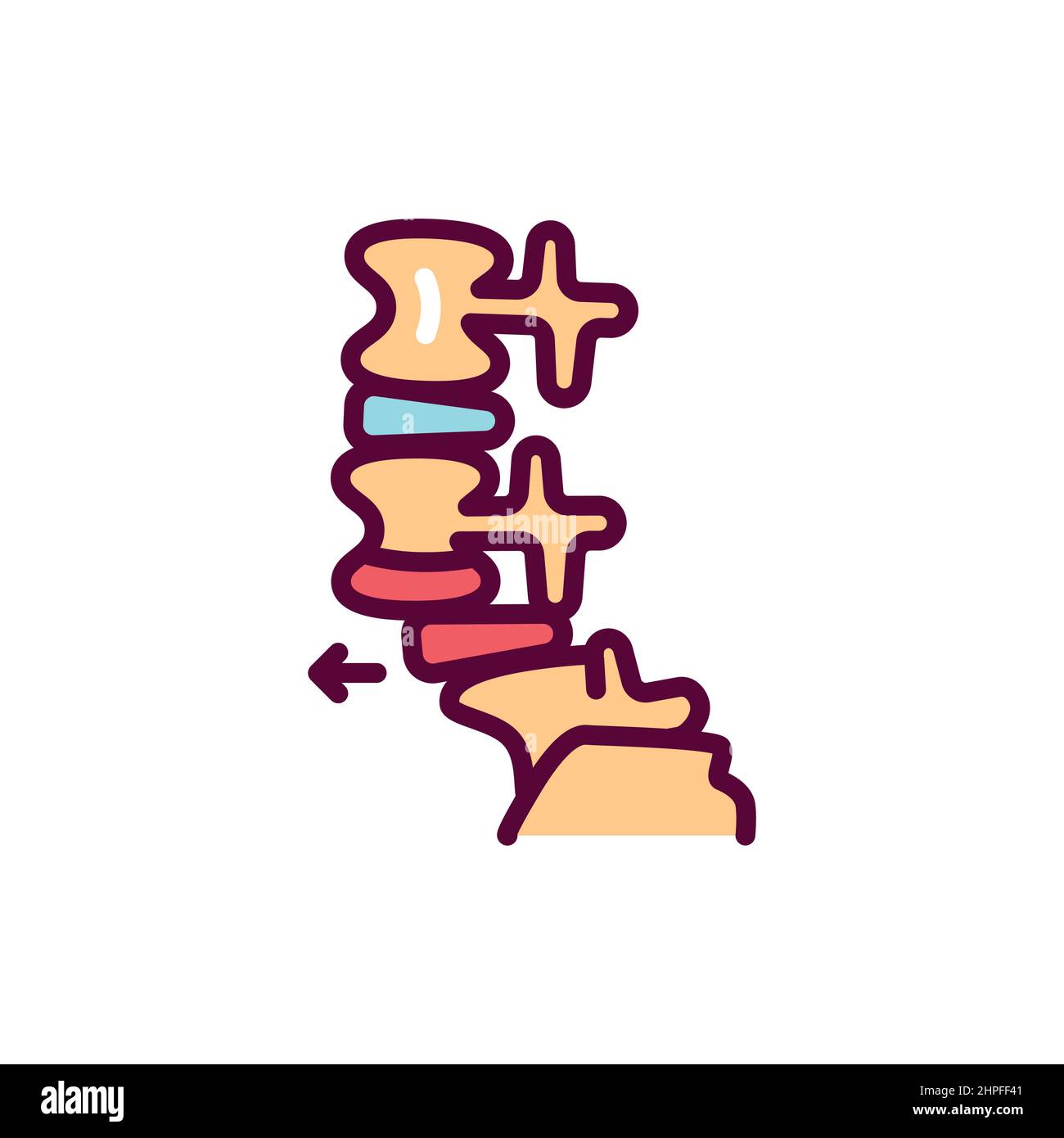 Symbol für die Spondylolisthese-Linie. Isoliertes Vektorelement. Stock Vektor