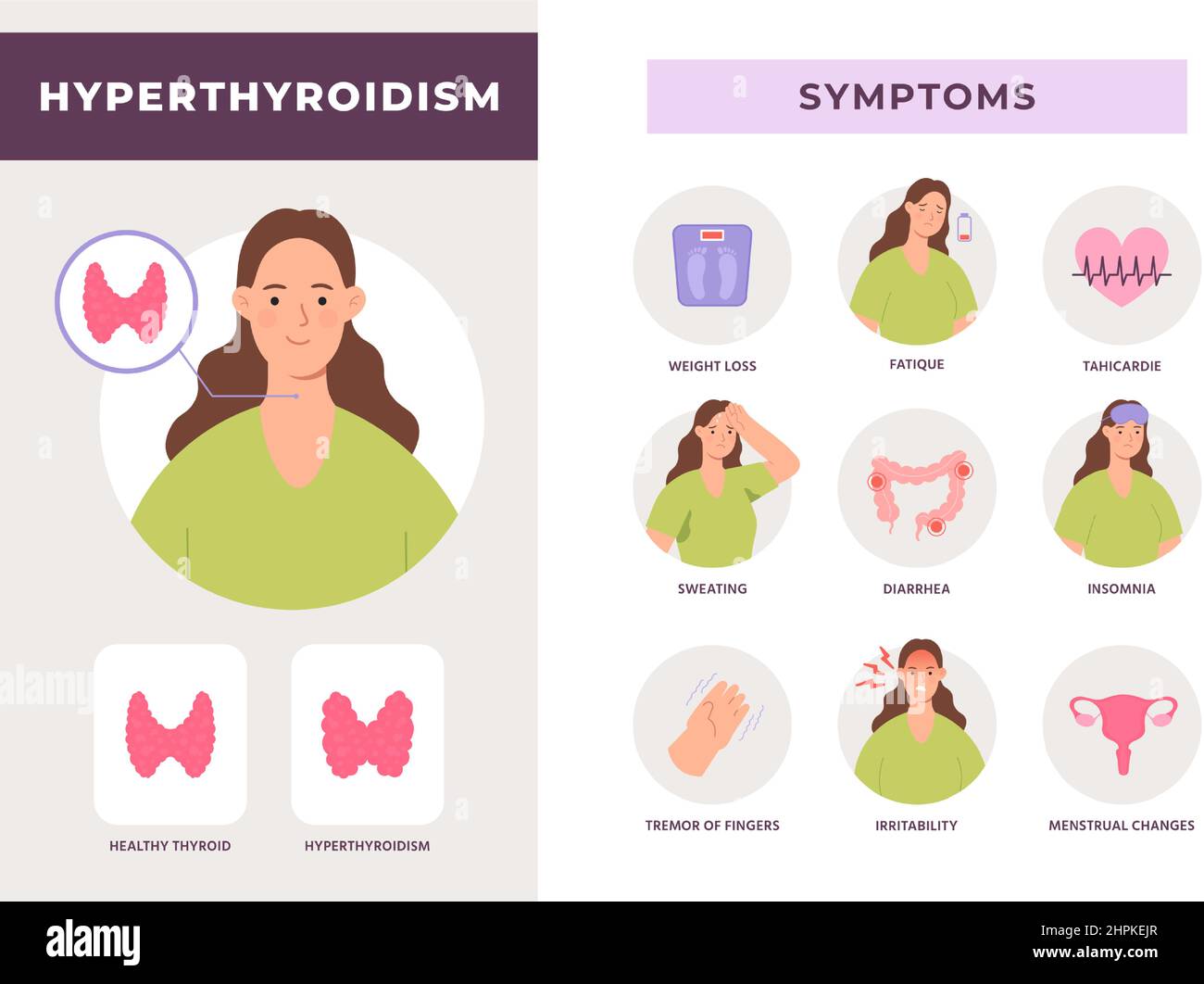 Symptome einer Schilddrüsenüberfunktion Infografik, überaktive Schilddrüsenerkrankung. Gesundheit des endokrinen Systems mit flachem Frauen-Charakter-Vektor-Poster Stock Vektor