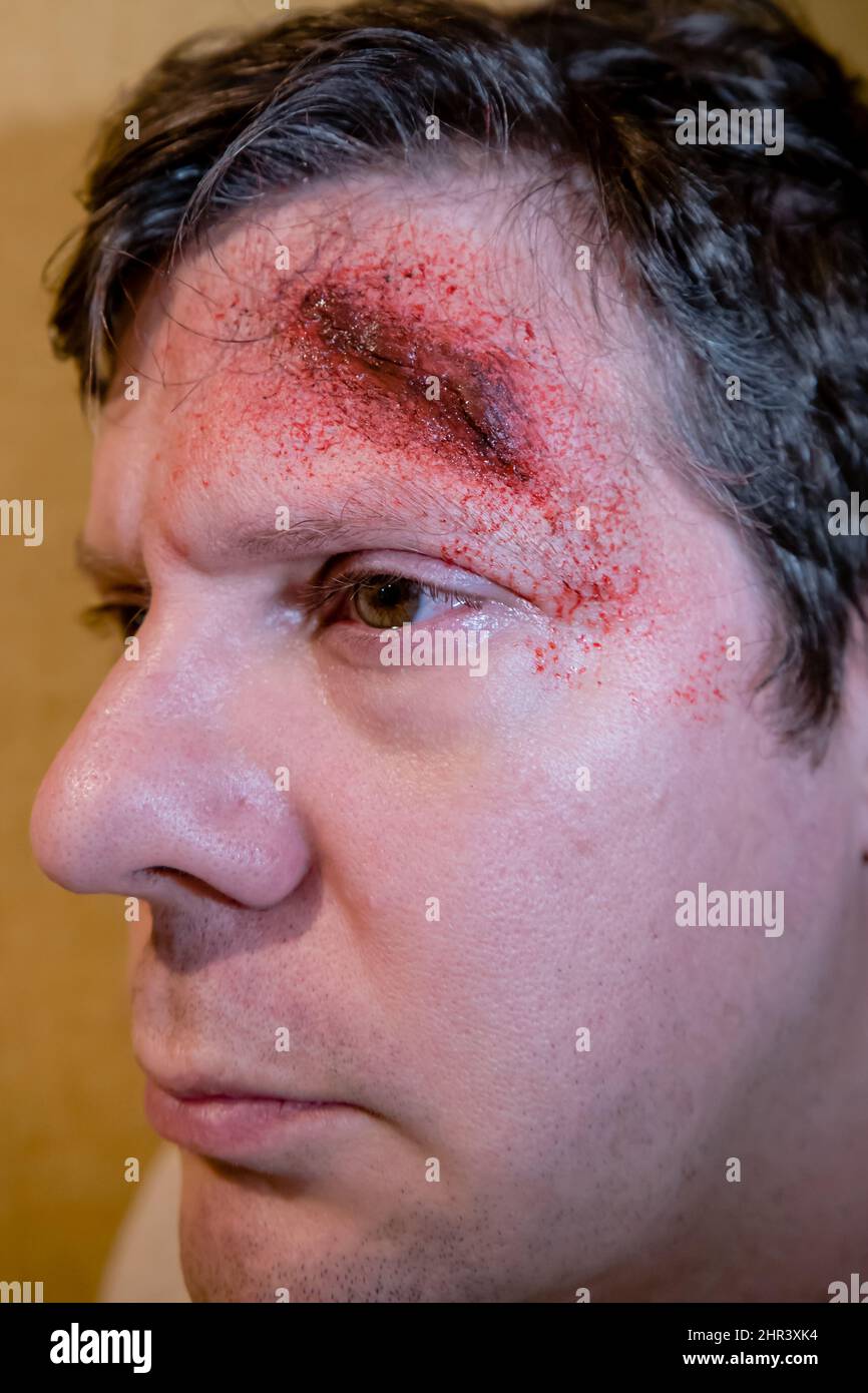 Erwachsener Mann mit Spezialeffekten, die aus einer Kopfwunde mit offener Wunde und Blutspritzer entstehen Stockfoto