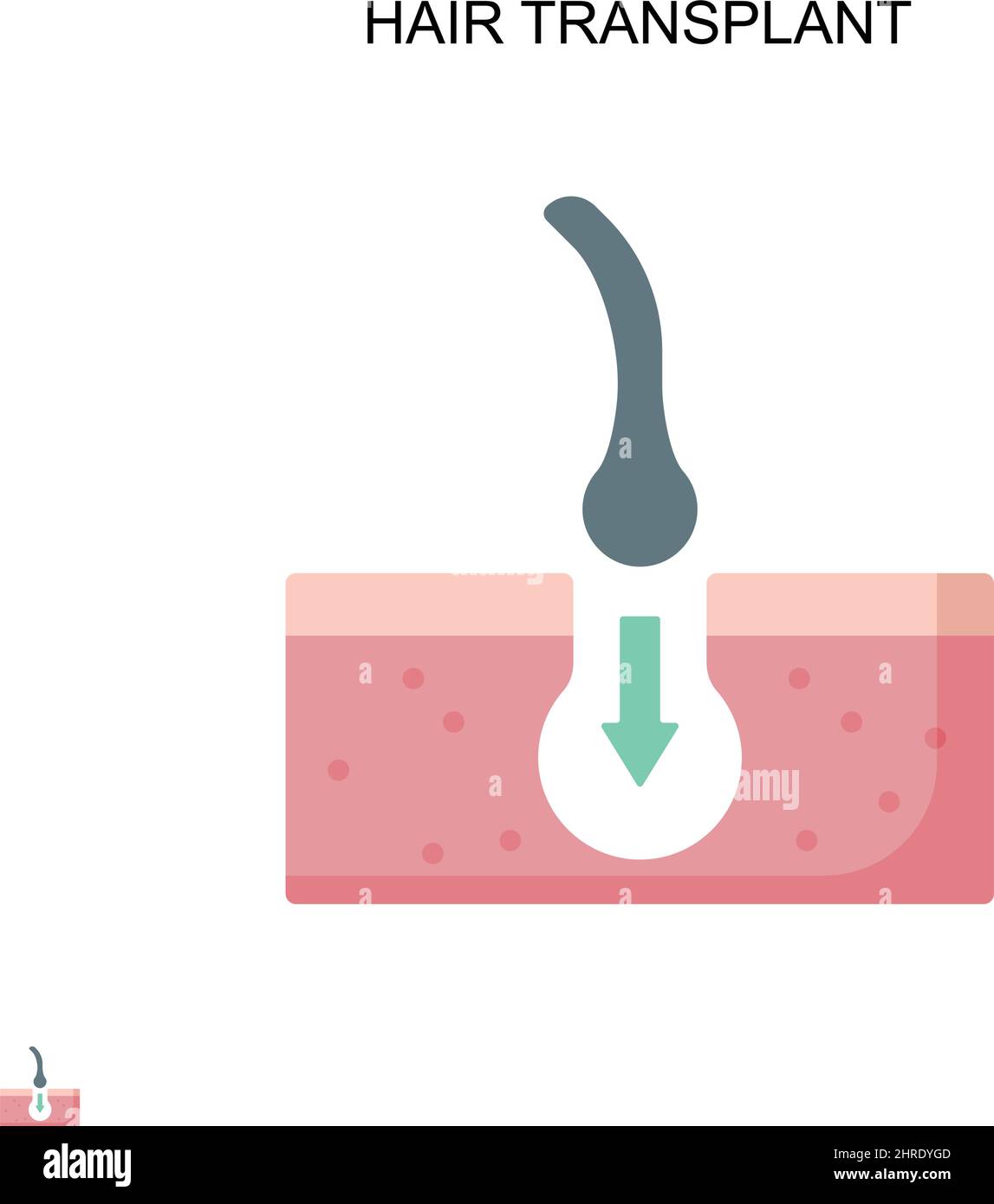 Einfaches Vektor-Symbol für Haartransplantation. Illustration Symbol Design-Vorlage für Web mobile UI-Element. Stock Vektor Einfaches Vektor-Symbol für Haartransplantation. Illustration Symbol Design-Vorlage für Web mobile UI-Element. Stock Vektor