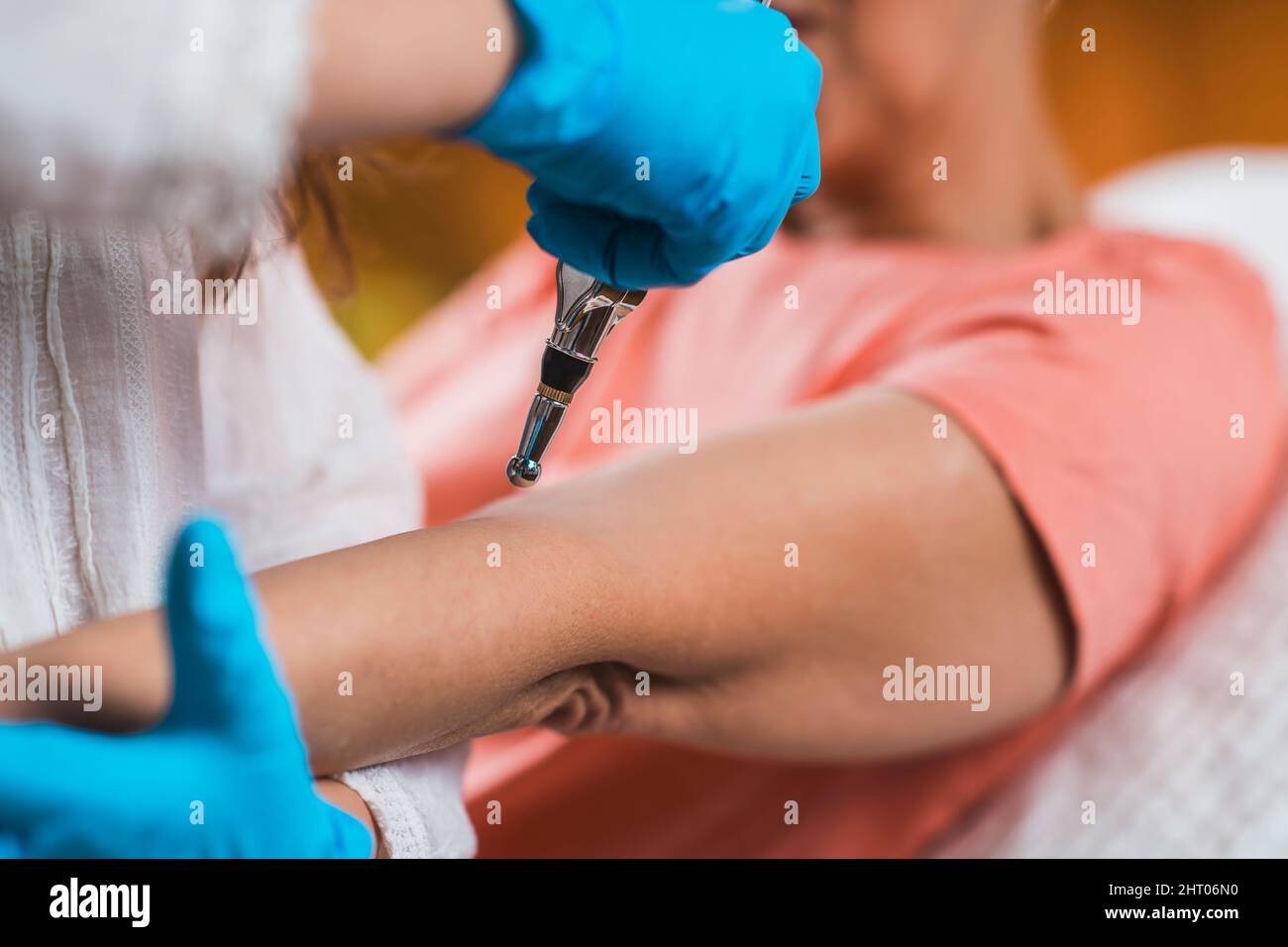 Frau, die Ellenbogenbehandlung mit Meridiantherapie-Stift erhält Stockfoto