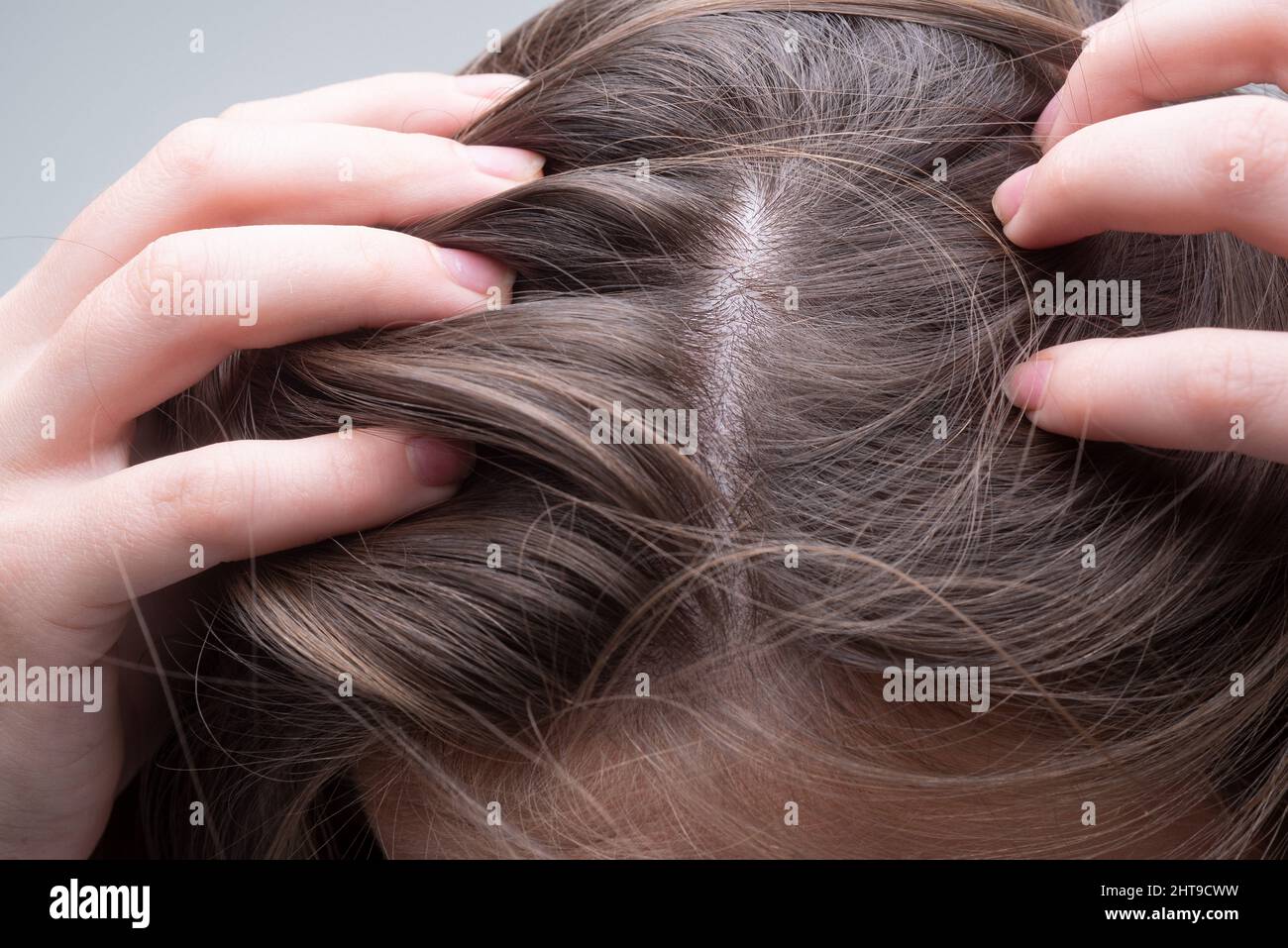 Nahaufnahme einer Frau, die ihre Haare und ihre Haare, Haarausfall am  Haaransatz oder trockenes Kopfhautproblem untersucht Stockfotografie - Alamy