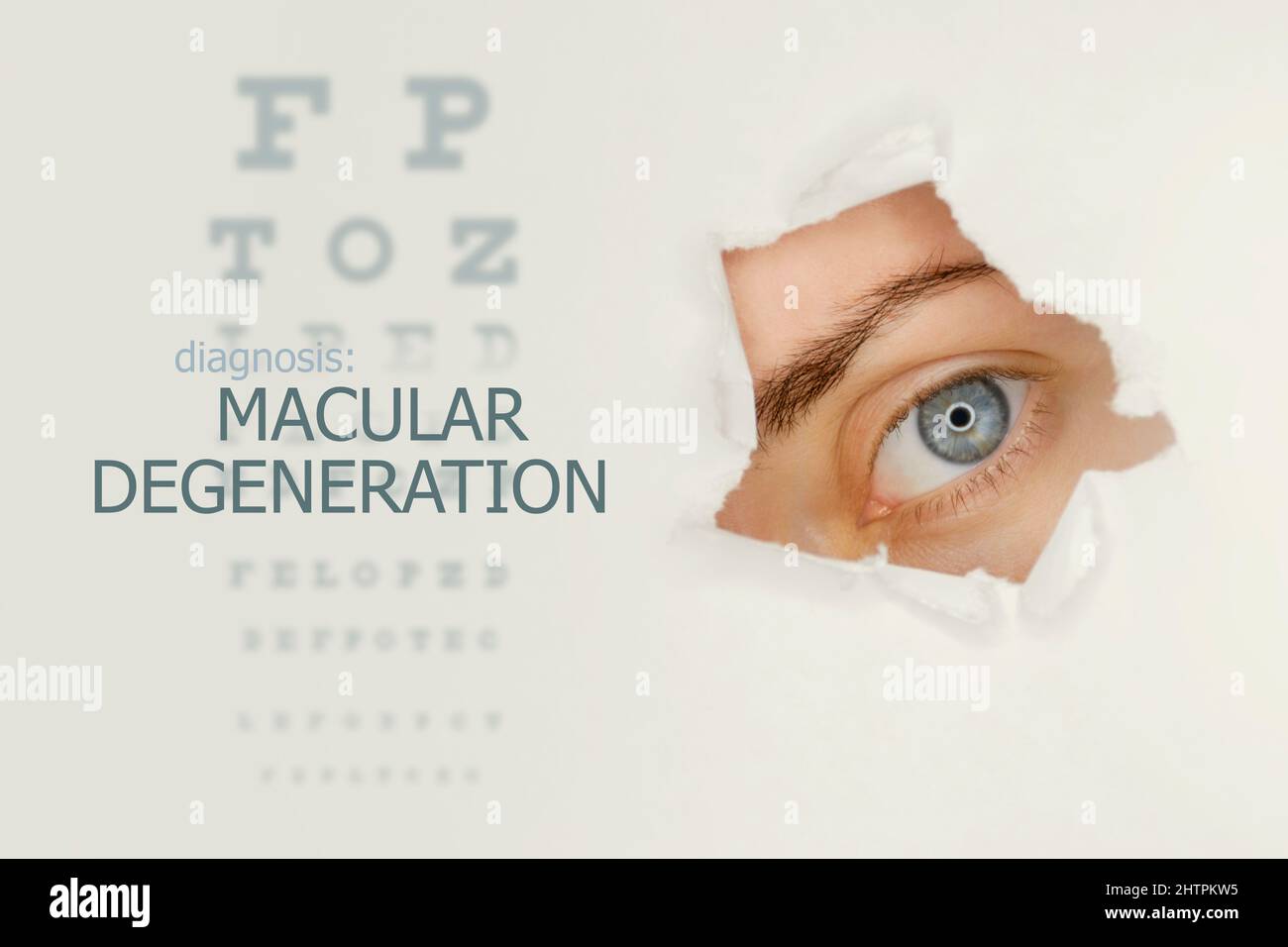 Poster zur Makuladegeneration mit Augentestdiagramm und blauem Auge. Studio grauer Hintergrund Stockfoto