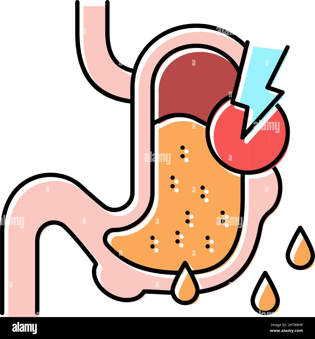 Lecks in der Darstellung der Farbsymbole des gastrointestinalen Systems Stock Vektor