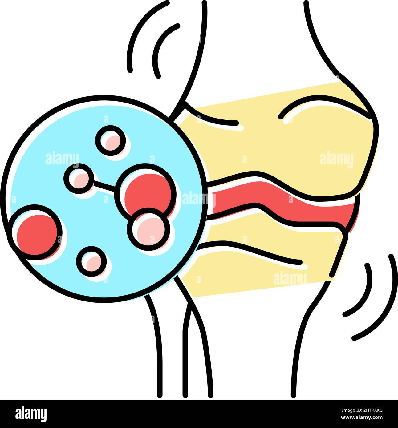 Juvenile idiopathische Arthritis Farbe Symbol Vektor Illustration Stock Vektor