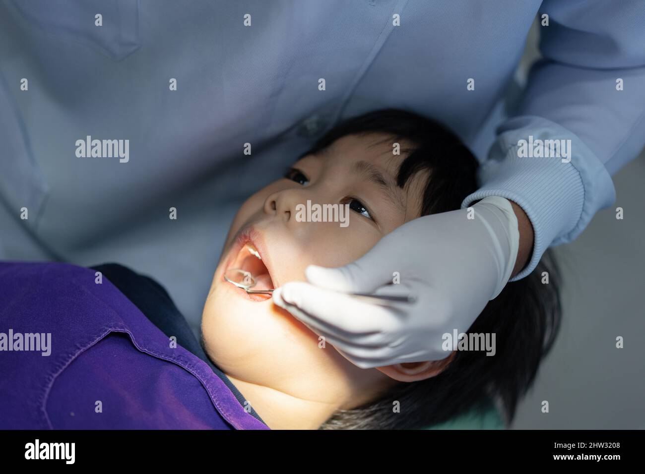 Hand of Doctor Zahnarzt arbeitet an den Zähnen der asiatischen kleinen Kind 6 Jahre alten Patienten in der Zahnklinik Stockfoto