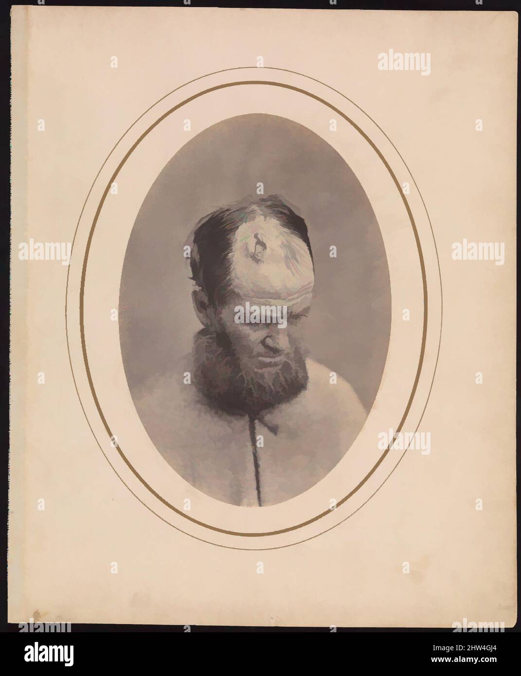 Art inspired by Private John Parkhurst, Company E, Second New York Heavy Artillery, 1865, Albumensilberdruck aus Glasnegativ, Bild: 18,9 × 13,1 cm (7 7/16 × 5 3/16 Zoll), oval, Fotografien, Reed Brockway Bontecou (Amerikaner, 1824–1907), Union Private Parkhurst erhielt einen Schuss, Classic Works modernisiert von Artotop mit einem Schuss Moderne. Formen, Farbe und Wert, auffällige visuelle Wirkung auf Kunst. Emotionen durch Freiheit von Kunstwerken auf zeitgemäße Weise. Eine zeitlose Botschaft, die eine wild kreative neue Richtung verfolgt. Künstler, die sich dem digitalen Medium zuwenden und die Artotop NFT erschaffen Stockfoto