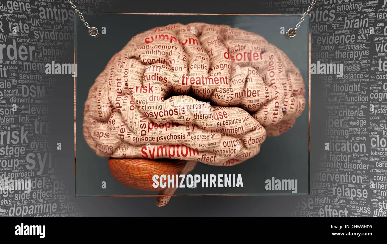 Anatomie der Schizophrenie - seine Ursachen und Wirkungen werden auf ein menschliches Gehirn projiziert und zeigen die Komplexität der Schizophrenie und die Beziehung zum menschlichen Geist auf. Konzeptkunst, Stockfoto