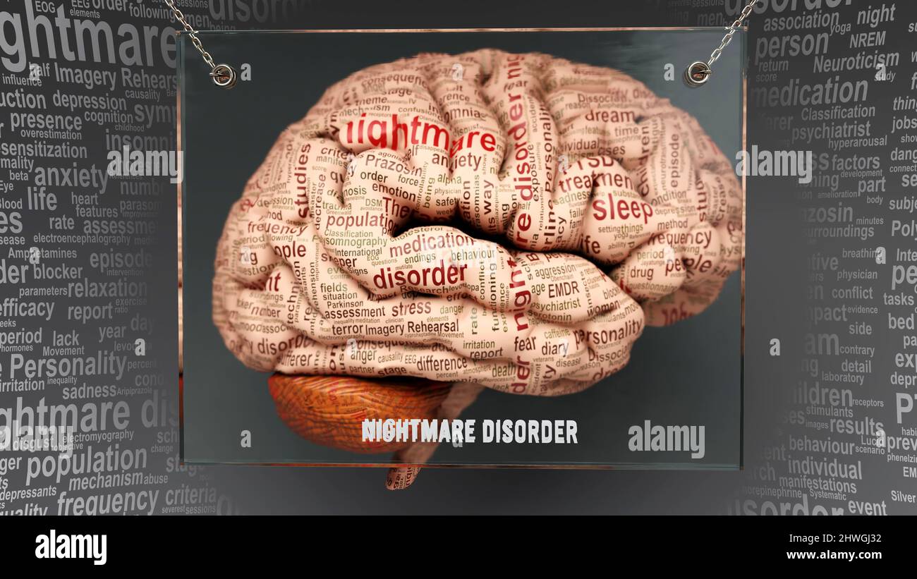 Alptraum-Störung Anatomie - seine Ursachen und Auswirkungen auf ein menschliches Gehirn projiziert Enthüllung Nightmare-Störung Komplexität und Beziehung zum menschlichen Geist. Kontra Stockfoto