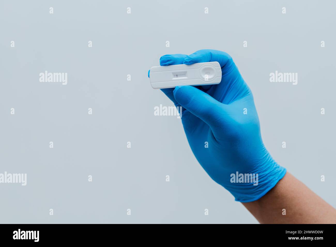 Eigene Hand mit negativem Covid-19-Testergebnis mit SARS CoV-2 Rapid-Antigen-Testkit Stockfoto