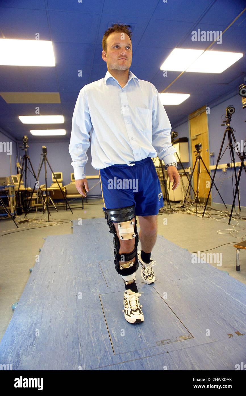 Ein männlicher Patient, der mit einer Donjoy-Prothese am rechten Bein ausgestattet ist, übt das Gehen mit der neuen Passform. (MODEL RELEASED) Stockfoto