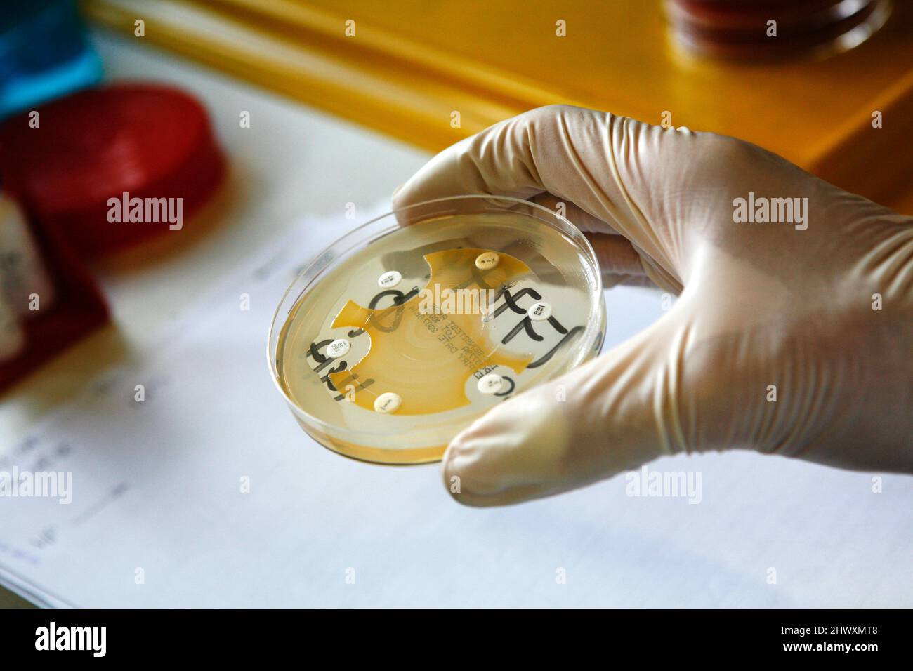 Untersuchung von Bakterienkulturen in einer Petrischale Stockfoto