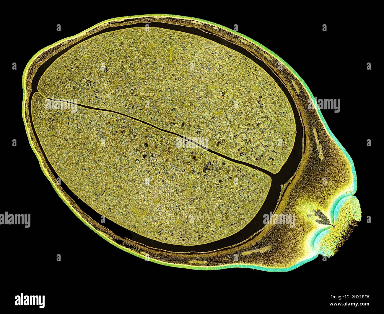 Schnittschnitt eines Pflanzenstamms unter dem Mikroskop – mikroskopische  Ansicht von Pflanzenzellen für die botanische Ausbildung – hohe Qualität  Stockfotografie - Alamy