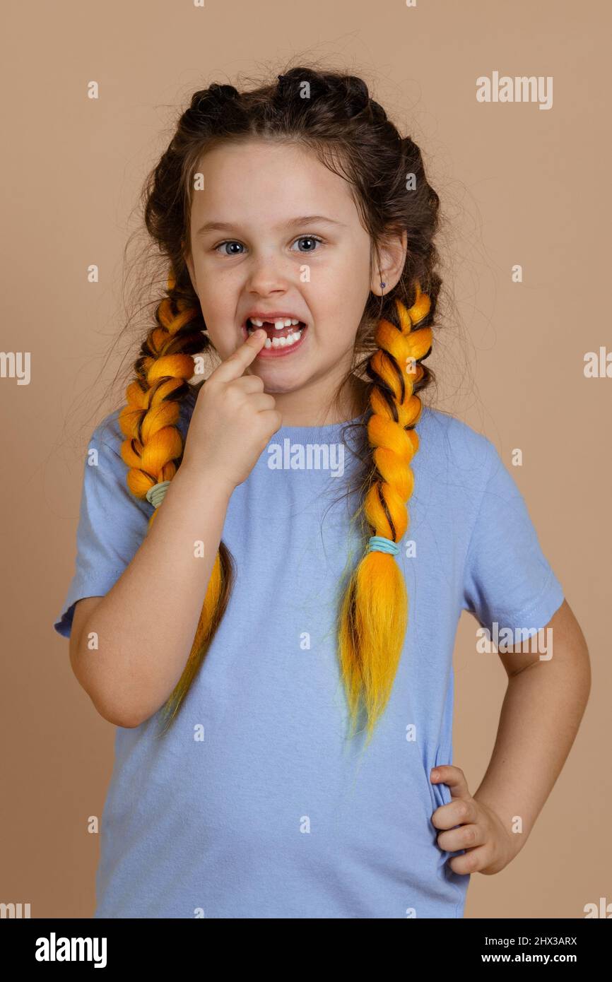 Kleines kaukasisches Kind mit dem Finger, der auf den Mund zeigt und einen fehlenden Zahn zeigt, der beim Blick auf die Kamera mit Kanekalon-Zöpfen auf dem Kopf auf Beige schmerzt Stockfoto