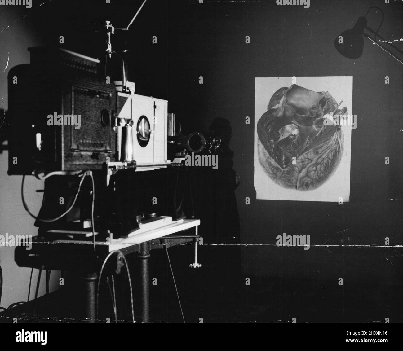 Epidiascope wird verwendet, um fotografische Dias oder Bilder von tatsächlichen Exemplaren für Vorträge auf einen Bildschirm zu projizieren. Das Bild, das hier an die Wand geworfen wird, ist von einem kranken menschlichen Herzen. 27. April 1946. Stockfoto
