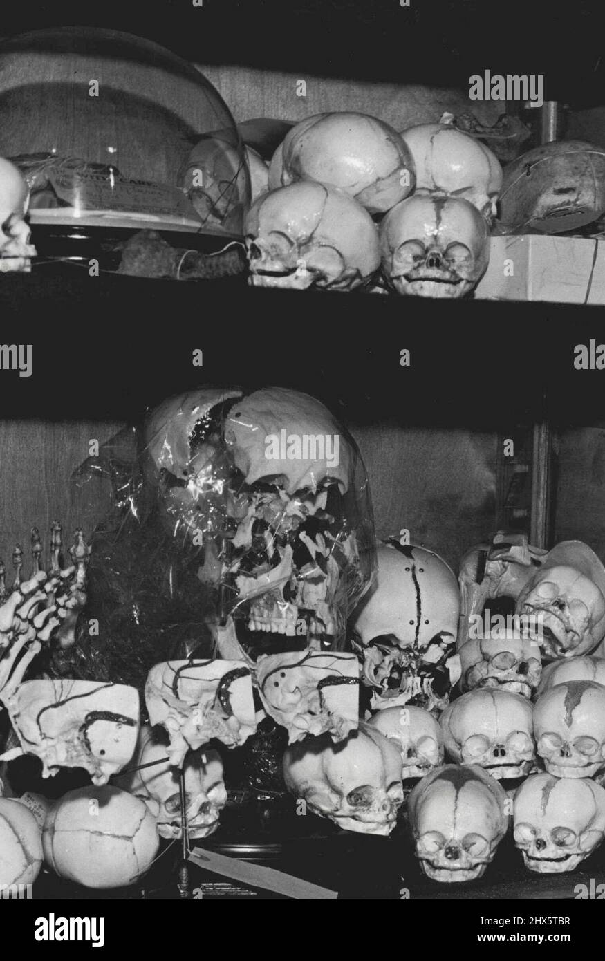 Embryonen in Einem Kabinett: Schädel von Embryonen, einige vor, einige nach der Geburt, bieten einen ziemlich grobkörnigen Eindruck. Durch den Mangel an Zähnen scheinen ihre Gesichter ein dauerhaftes Grinsen zu zeigen. November 01. 1950. Stockfoto