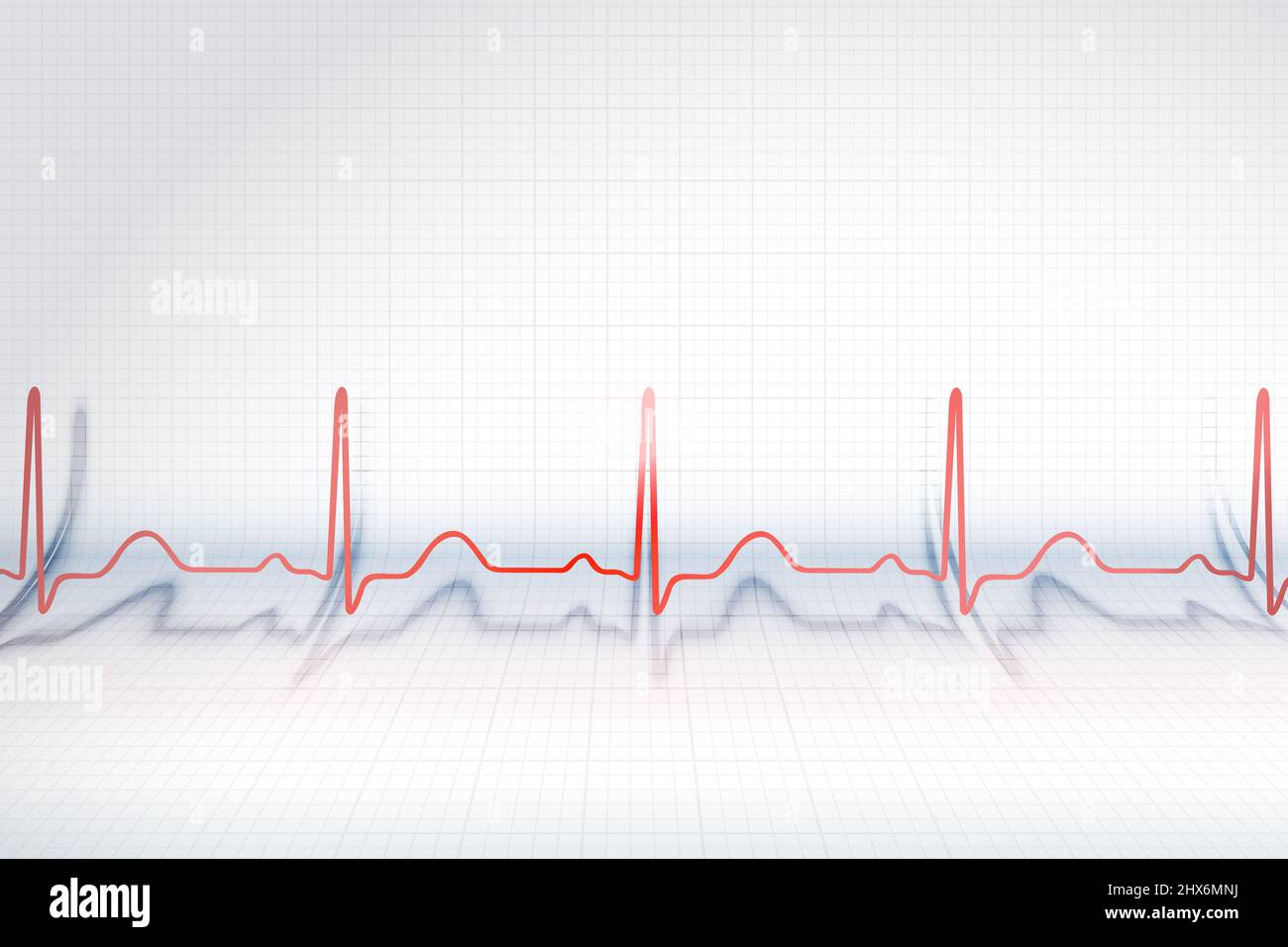 Rote Linie des EKG-Diagramms auf dem Hintergrund des gebogenen Plotzpapiers/ Stockfoto