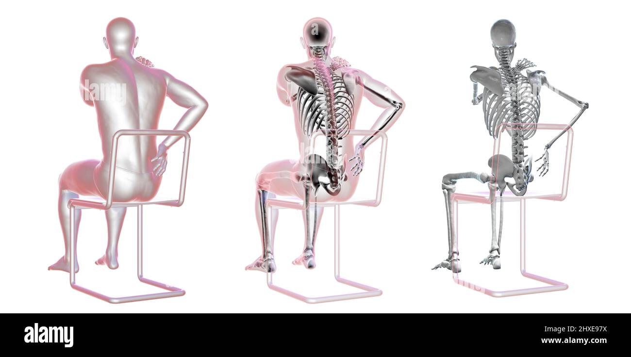 Rückenschmerzen, konzeptionelle Darstellung Stockfoto