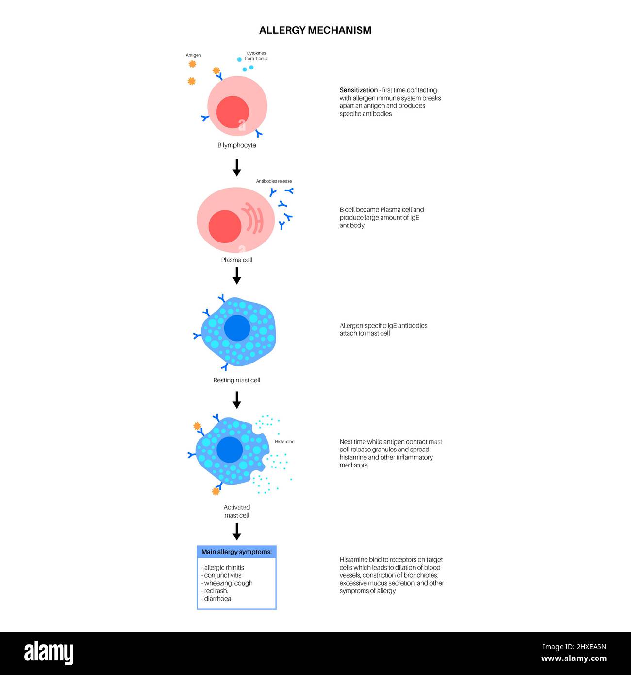 Allergiemechanismus, Abbildung Stockfoto