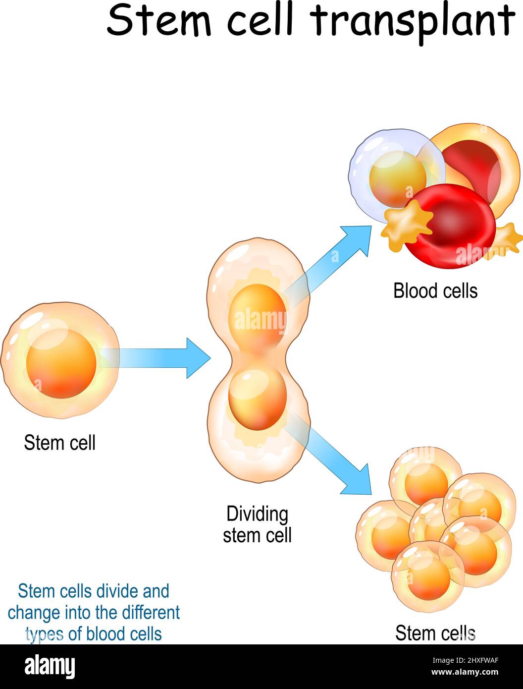 Stammzelltransplantation. Stammzellen teilen sich und wandeln sich in die verschiedenen Arten von Blutzellen um. Vektorgrafik Stock Vektor