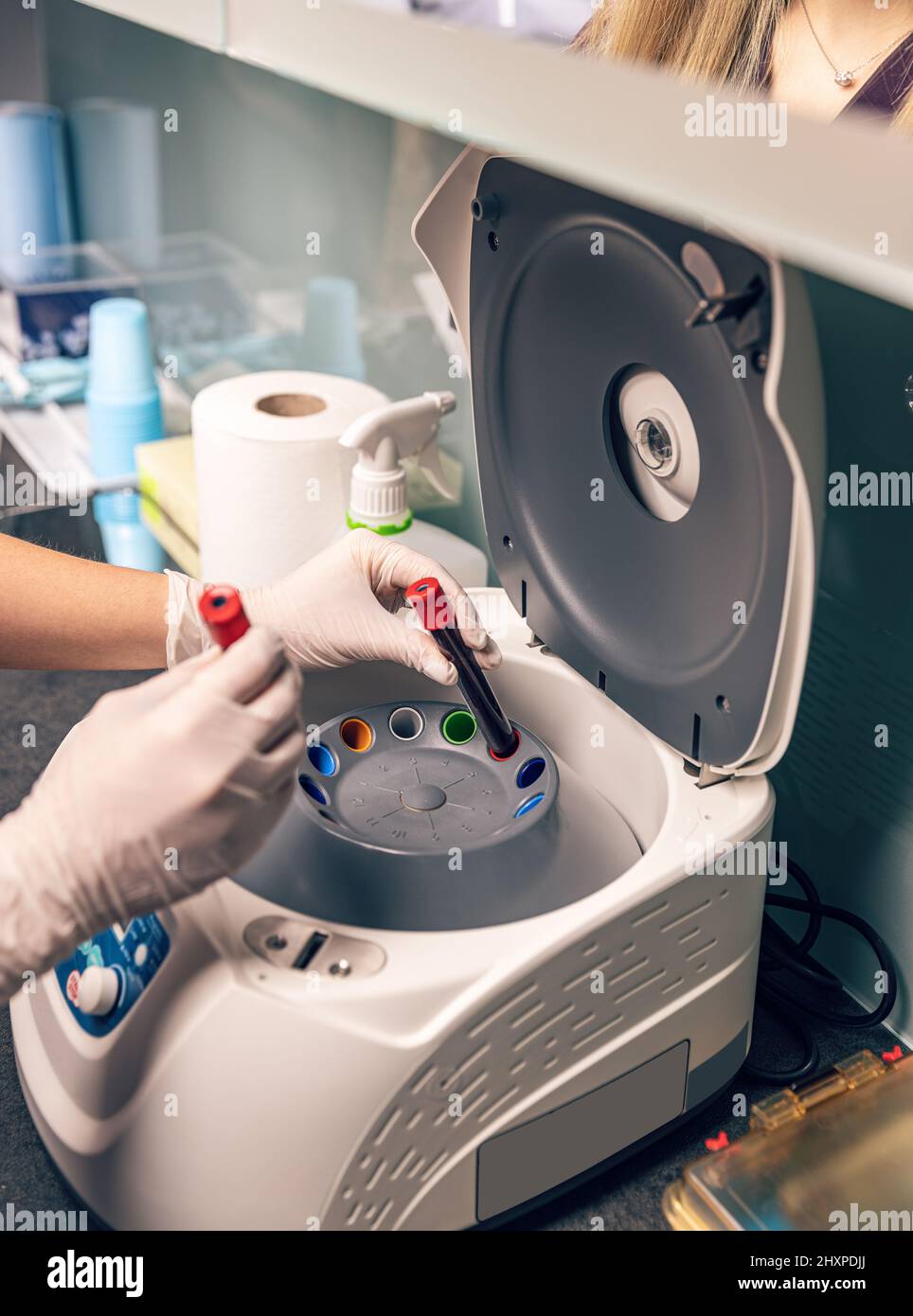 Die Krankenschwester legte Blutprobe in die Laborzentrifuge, um Flüssigkeiten zu trennen. Stockfoto