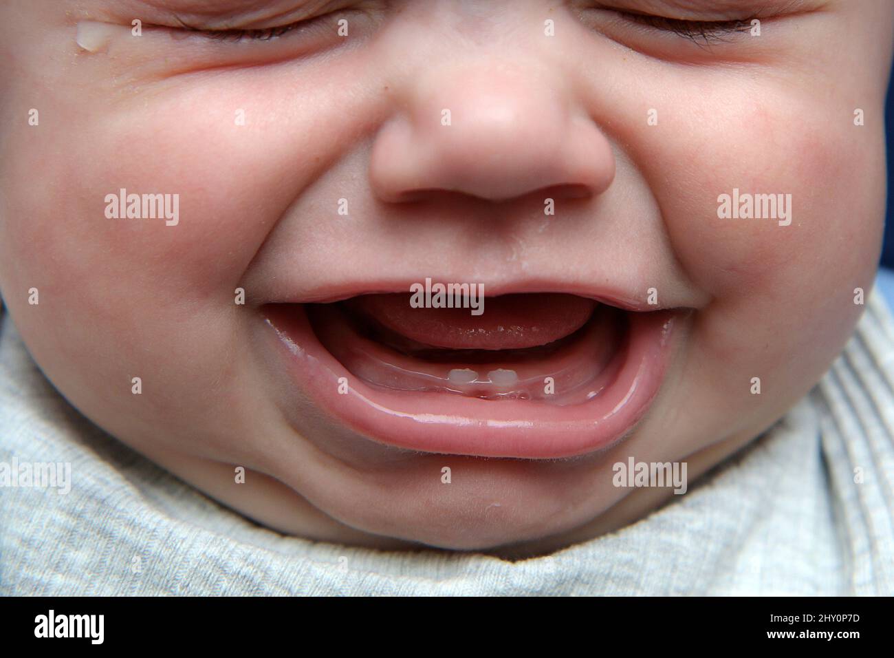 Das Detail des Mundes eines Babys mit ein paar ersten Zähnen. Es weint, da das Zahnfleisch und die Zähne schmerzhaft sind. Stockfoto
