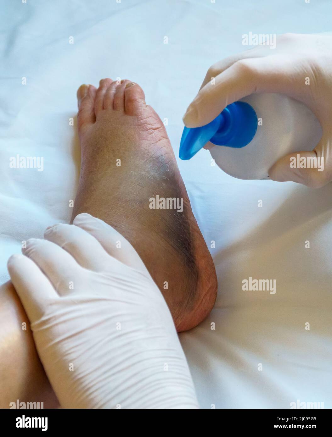 Der Arzt gibt dem verletzten Bein Creme. Stockfoto