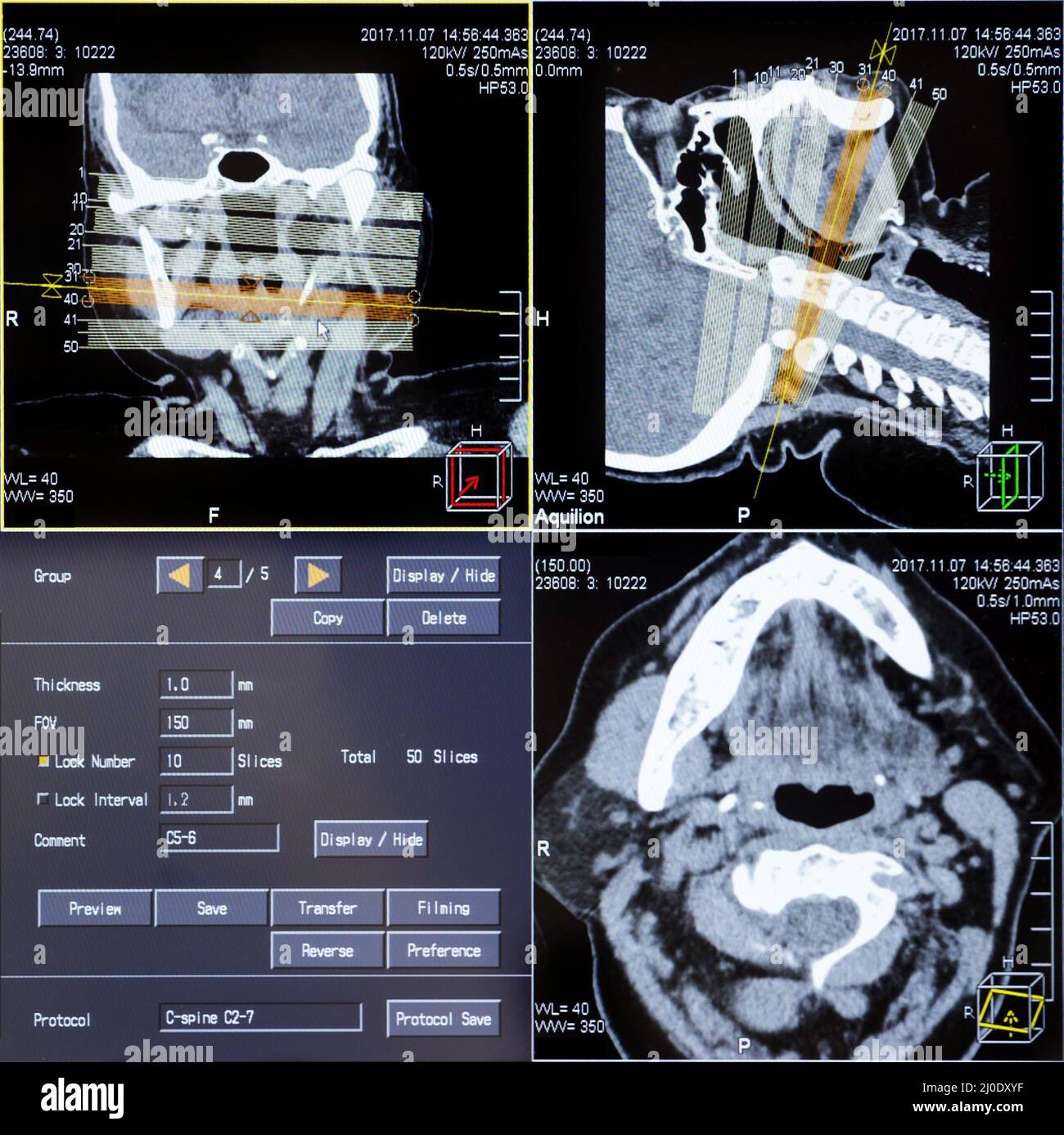 CT-Scans des menschlichen Kopfes Stockfoto
