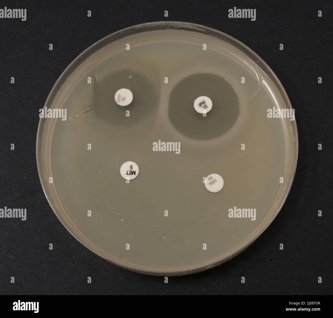 Foto des Wachstums von Bakterienkolonien um Antibiotika-Scheiben Stockfoto