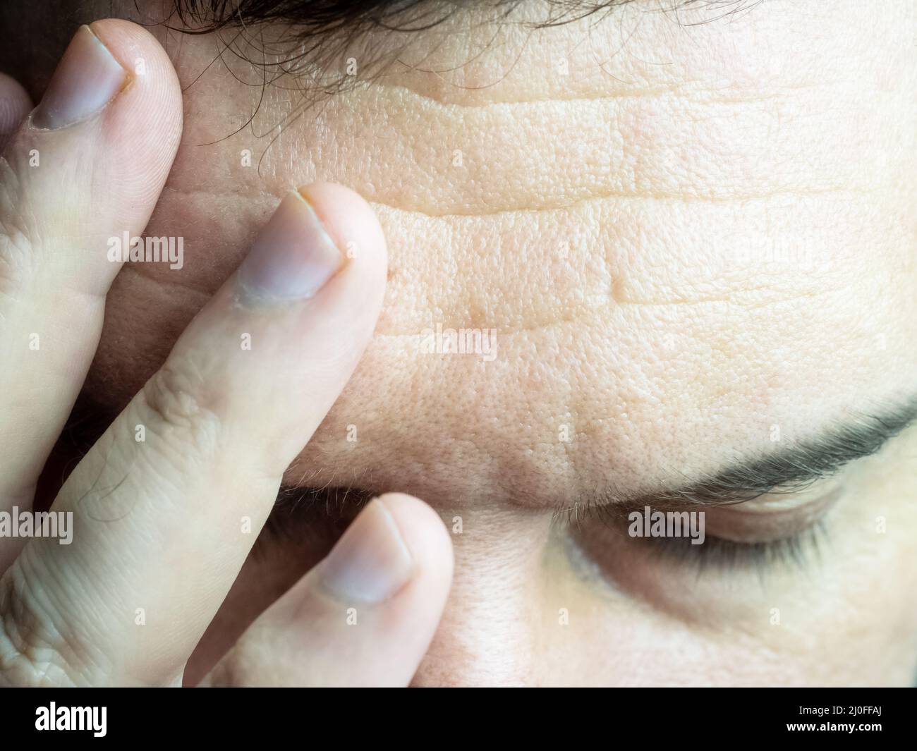 Ein Nahaufnahme-Foto von einem Mann, der seine Finger auf die Stirn drückt, seine Stirn faltert und seine Augen schließt, was Kopfschmerzen zeigt Stockfoto