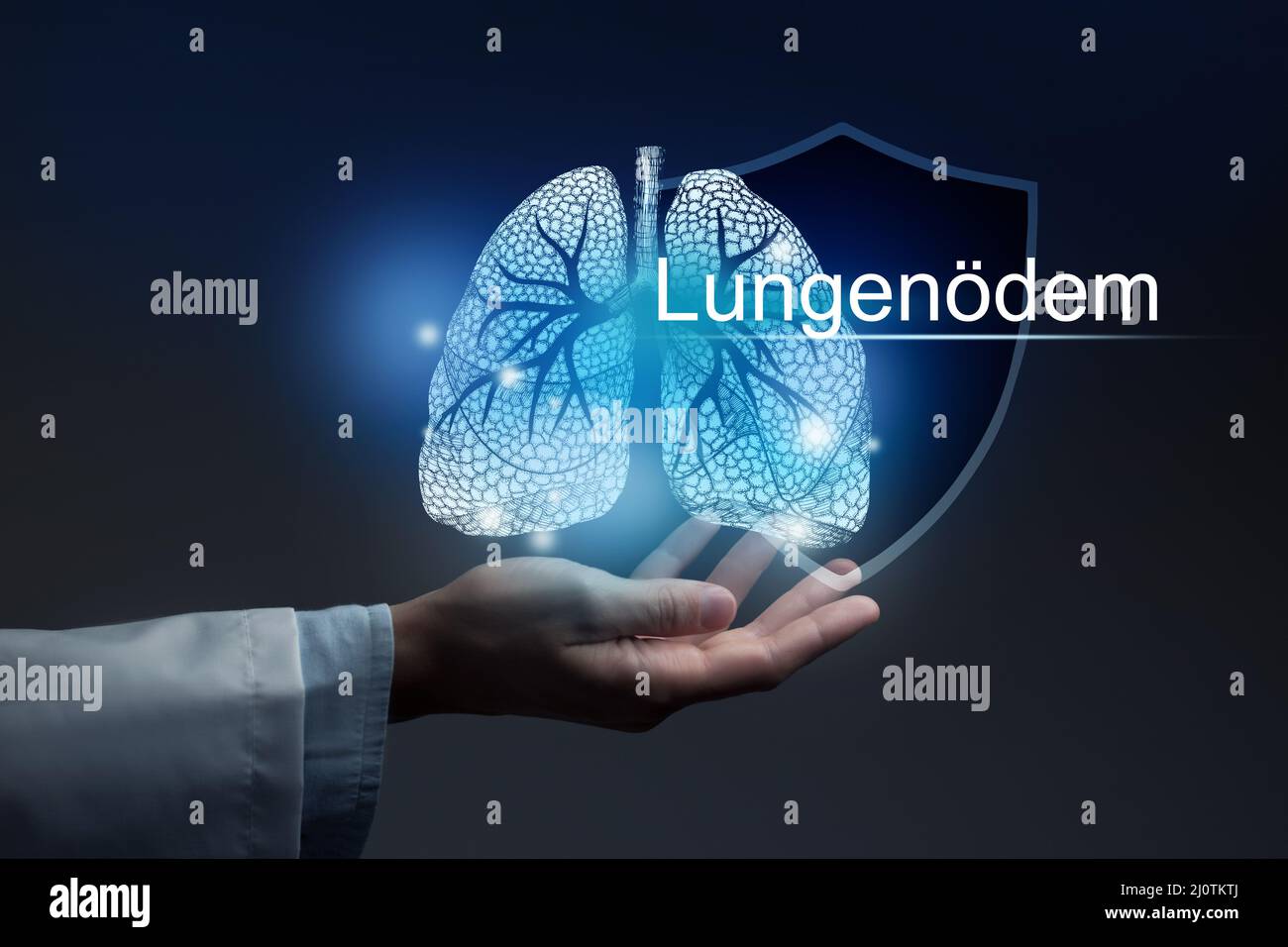 Medizinisches Banner Lungenödem mit deutscher Übersetzung Lungenödem auf blauem Hintergrund mit großem Textraum oder Checkliste. Stockfoto