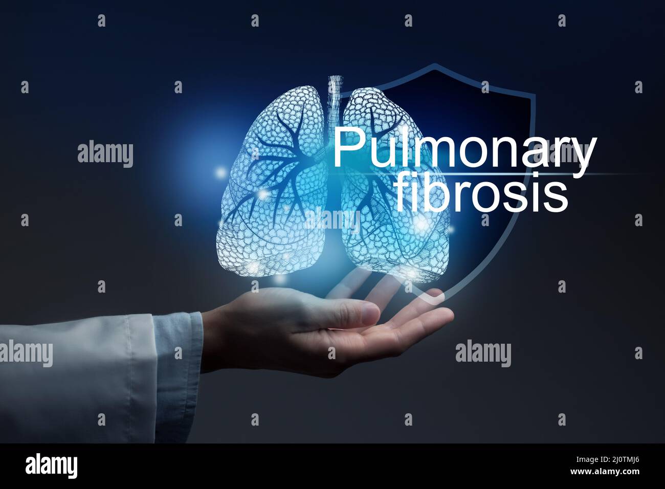 Medizinisches Banner Pulmonale Fibrose auf blauem Hintergrund mit großem Platz für Text oder Checkliste. Stockfoto