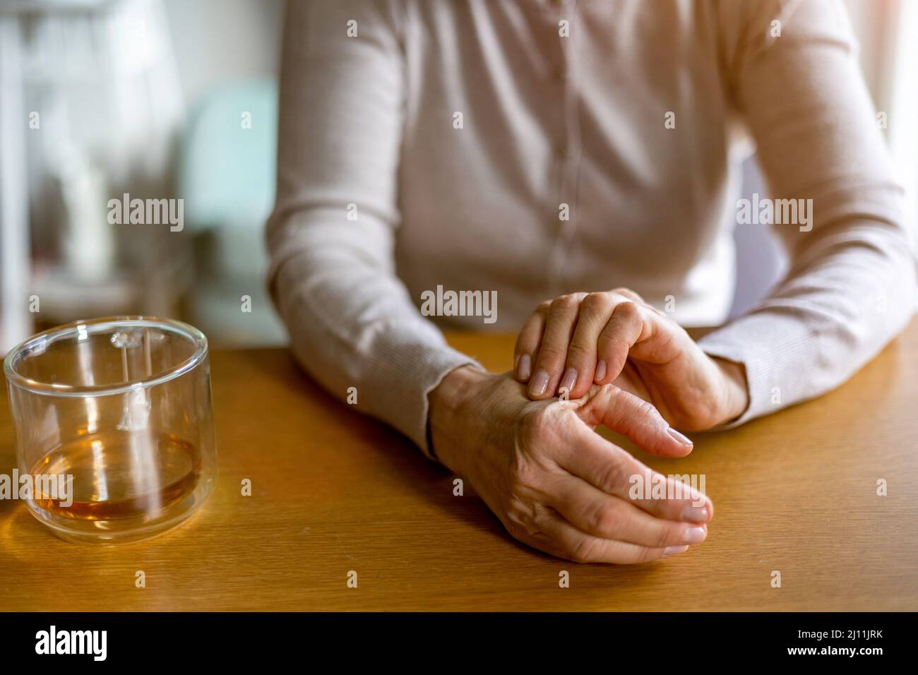 Ältere Frau mit reibenden Händen der Arthritis Stockfoto