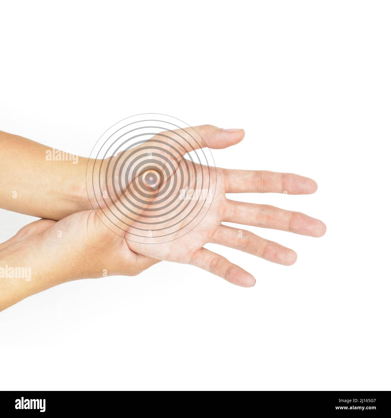 Schmerzhafter Palmar-Aspekt des asiatischen jungen Mannes. Konzept des Kompartiment-Syndroms und Schmerzen der Handmuskulatur. Stockfoto