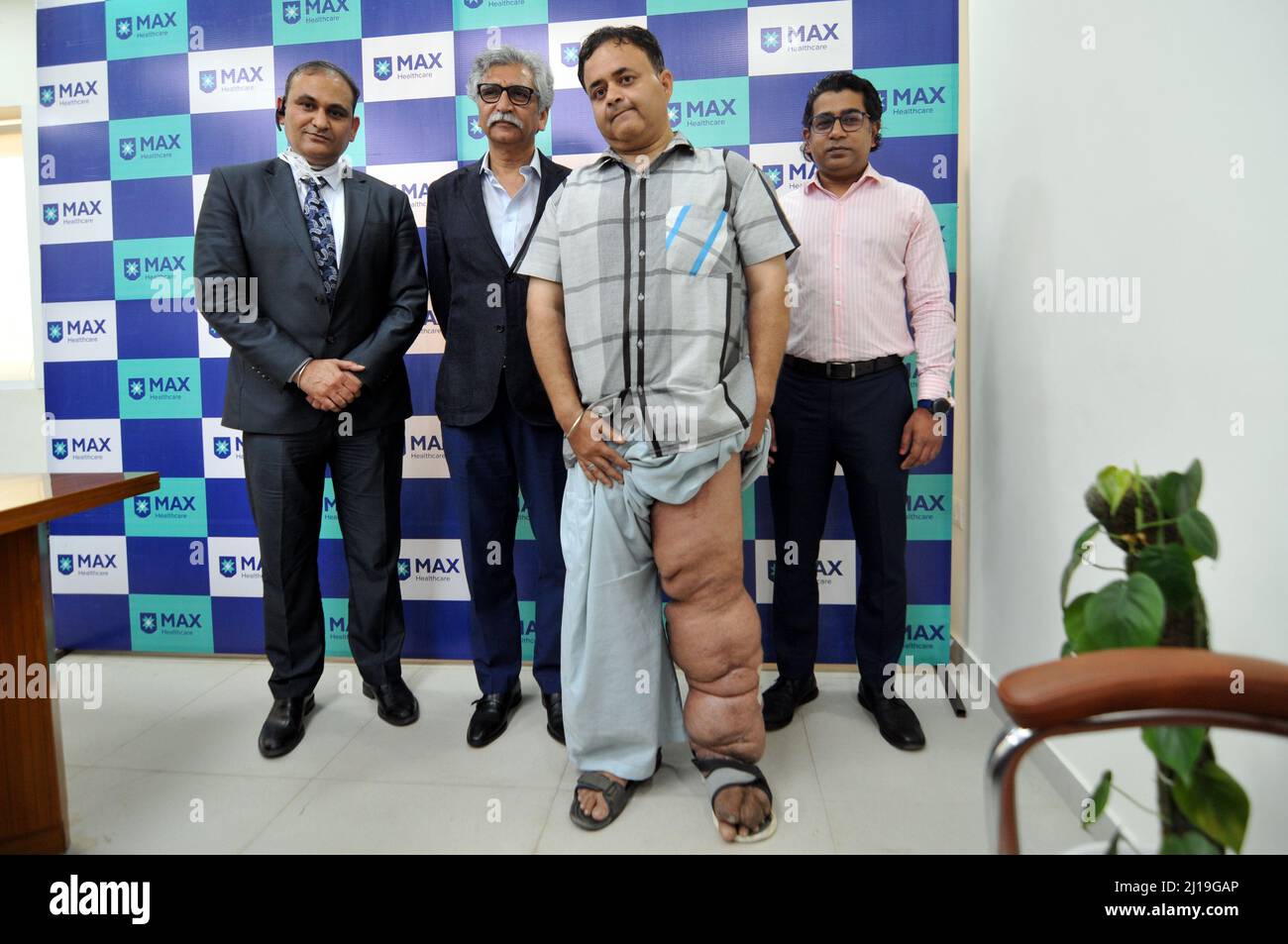 Neu-Delhi, Indien. 23. März 2022. Patient Amit Kumar ein Mann mit einem 45 kg schweren Bein, 120 cm, der zum ersten Mal seit 10 Jahren ging, Pressekonferenz mit den Ärzten Manoj Johar und Pradeep singh, die am 23. März 2022 in Delhi, Indien, bei Amit unter Elephantiasis operiert wurden. Das Ärzteteam würde die neuesten mikrochirurgischen Techniken und die Entstehung von Super-Mikrochirurgie diskutieren, um Patienten mit Krankheiten wie Elephantiasis Hoffnung zu geben. (Foto: Ravi Batra/Sipa USA) Quelle: SIPA USA/Alamy Live News Stockfoto