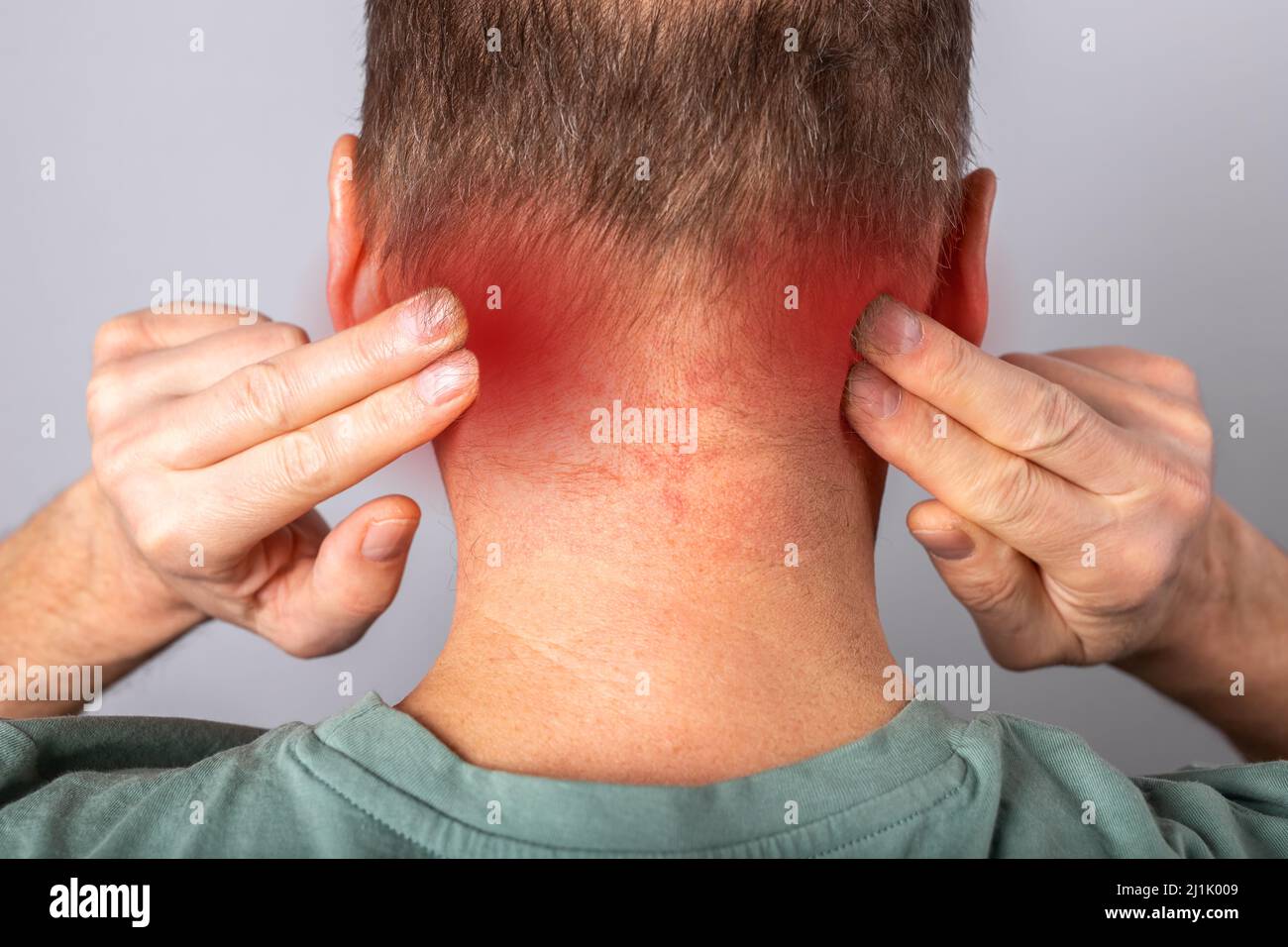 Nackenschmerzen aus der Nähe. Schmerzen im Nacken. Mann, der an Verletzungen, Belastungen leidet. Stockfoto