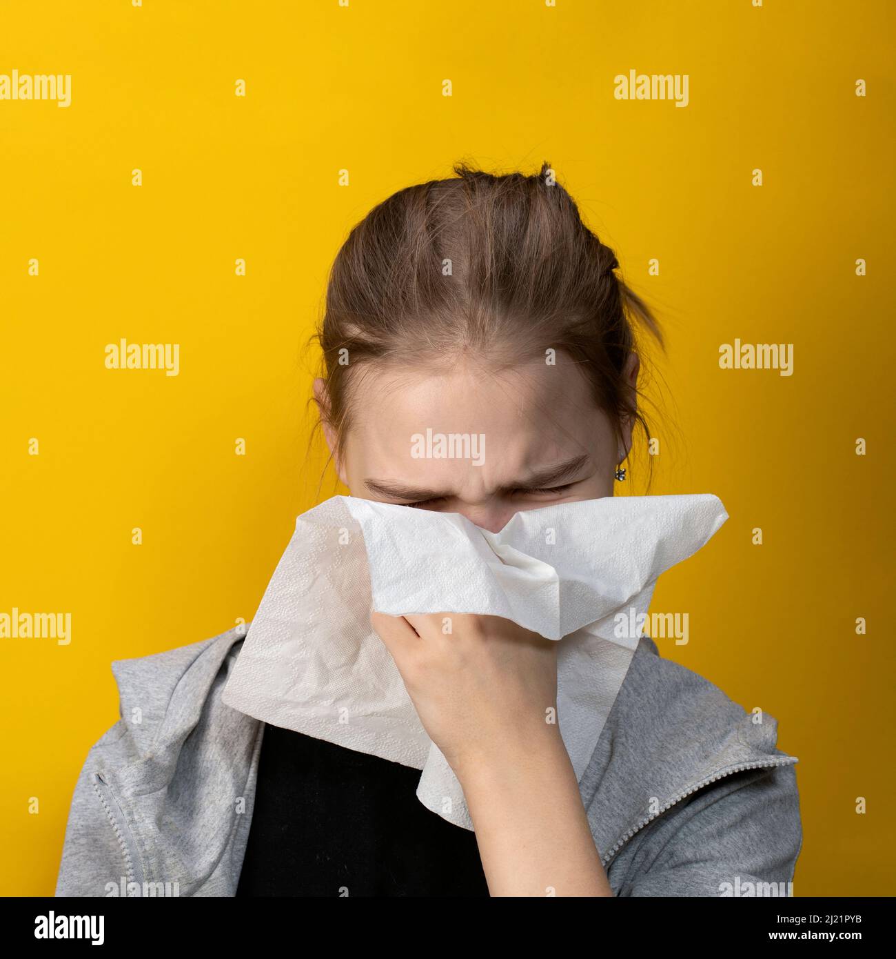 Krankes Mädchen, das ihre Nase in ein Taschentuch bläst, hat Symptome einer chronischen Sinusitis oder saisonalen Allergien Stockfoto