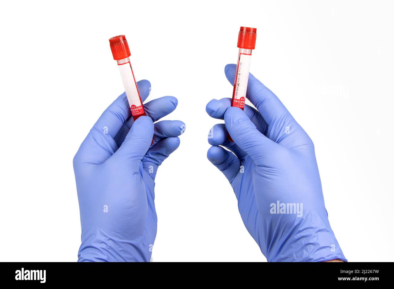 Hand haltenden Reagenzglas mit Blutplasma bereit für die Prüfung. Stockfoto